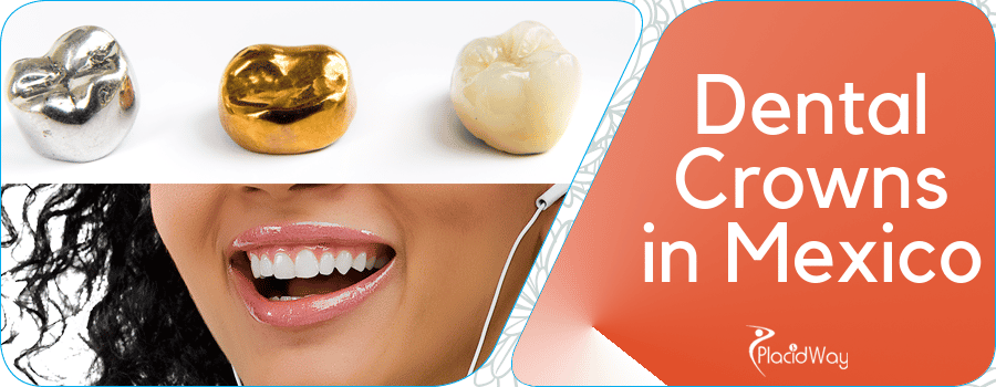 Dental Crowns in Puerto Vallarta